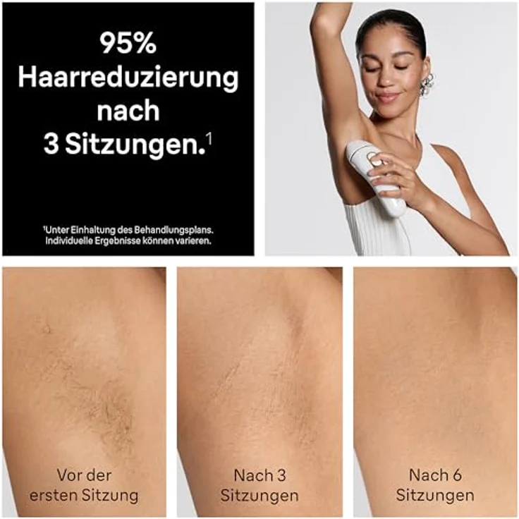 Braun Silk·expert Pro 5 PL5431, IPL Geräte zur Haarentfernung für Zuhause, inklusive Etui, Venus Rasierer und 4 Aufsätze, Weiß/Gold – Bild 5