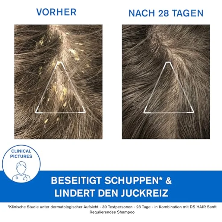 Uriage DS Hair Shampooing Traitant Kératoréducteur Shampoo 150 ml – Bild 7