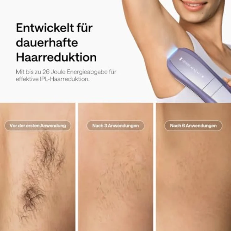 Ulike UI20S DB, IPL Haarentfernung Gerät mit Saphir-Eiskühltechnologie, Doppellicht und Hauttonerkennung – Bild 4
