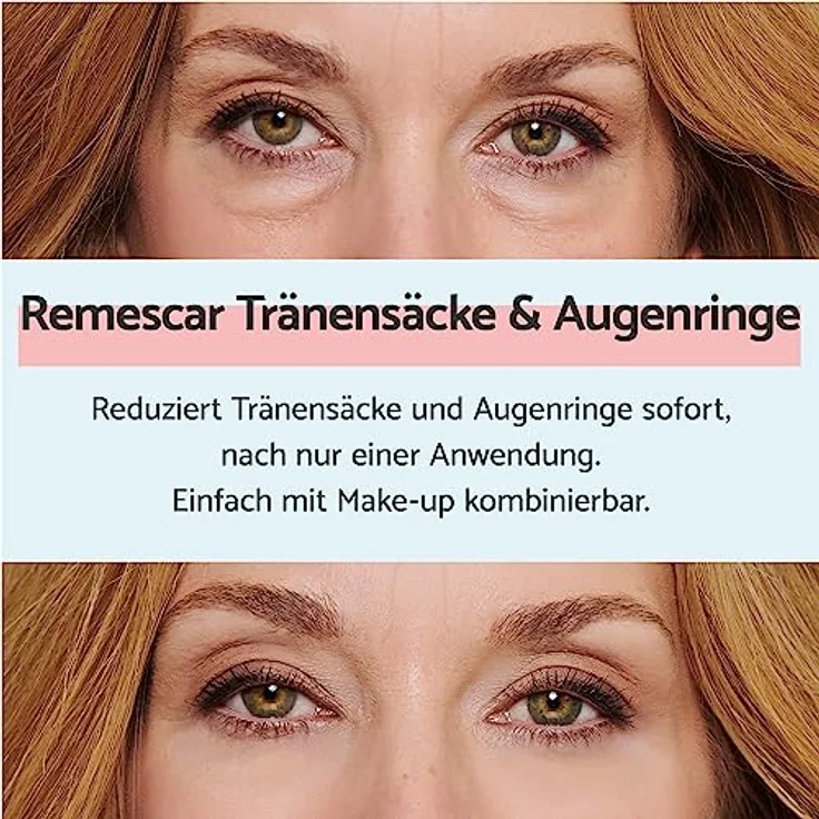 Remescar Eye Bags & Dark Circles 8 ml – Augencreme für Unteraugenbeutel und zum Entfernen von Beuteln unter den Augen – sofortige Behandlung für Augensäcke, 180 Anwendungen – Bild 2