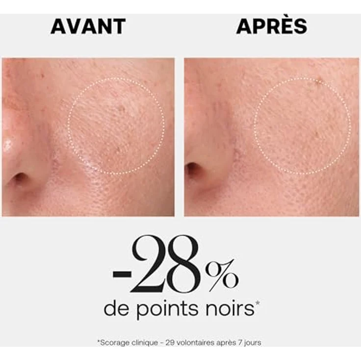 Rexaline HYALURX-BOOST Gel-in-Cellulose-Peeling – Hyaluronsäure RX2, sanfte Gesichtsreinigung mit Probiotika, entfernt abgestorbene Hautzellen & Mitesser für empfindliche Haut – 50 ml – Bild 3
