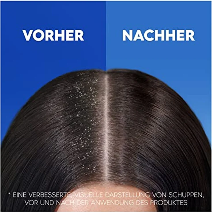Head & Shoulders Classic Clean 2in1 Anti-Schuppen Shampoo, bis zu 100% Schuppenschutz, 250ml – Bild 3