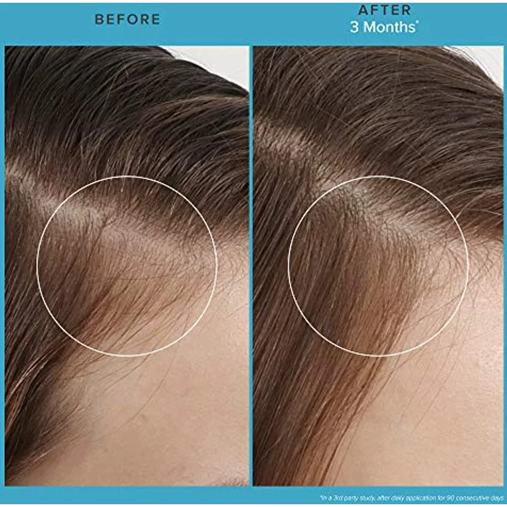 Living Proof Scalp Care Revitalizing Treatment 73 ml – Bild 4