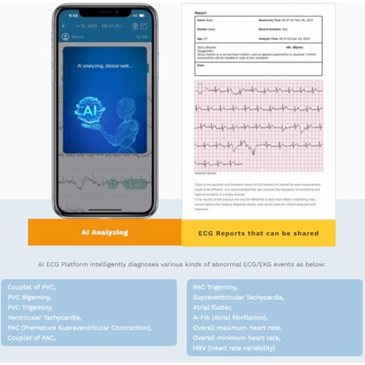 CheckMe Armfit Plus, Blutdruckmessgerät mit EKG-Analyse, automatische Messung in 30s, App für Android & iOS, Multi-User-Verwaltung, unbegrenzter Speicher – Bild 5