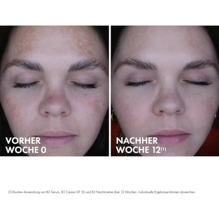 VICHY Anti-Pigmentflecken Tagescreme mit LSF 50, Für empfindliche, reife Haut, Mildert Pigmentflecken, Mit Bio-Peptiden und Niacinamid, Liftactiv B3, 50 ml – Bild 3