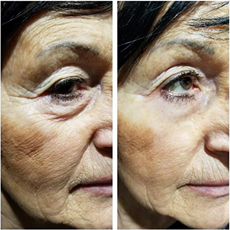 Instant Ageback - Lifting Creme 15 ml – Bild 6