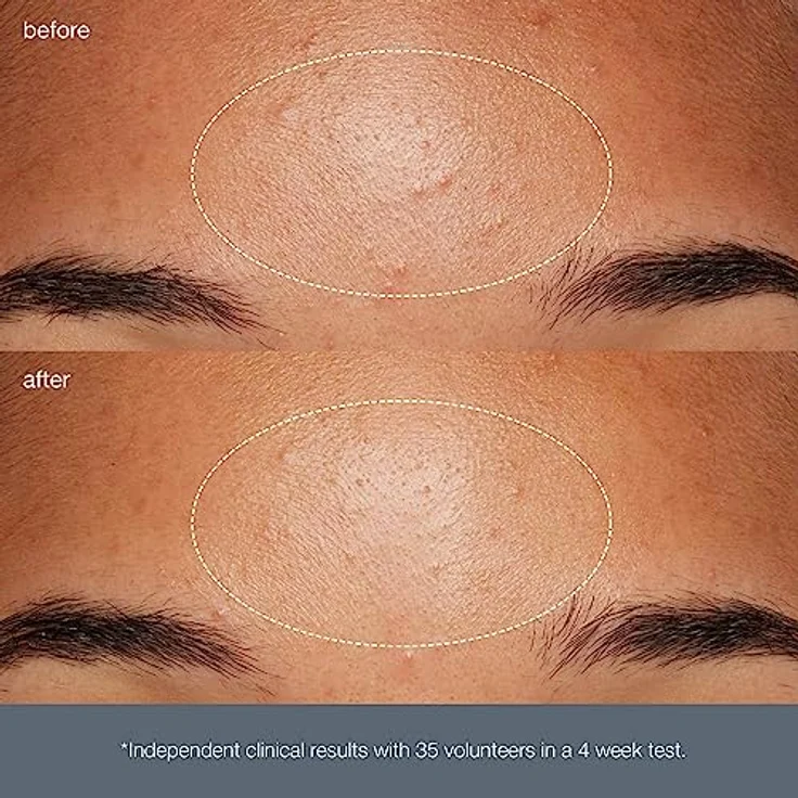 Dermalogica Exfoliants Daily Microfoliant Peeling 74 g, für alle Hauttypen geeignet – Bild 9