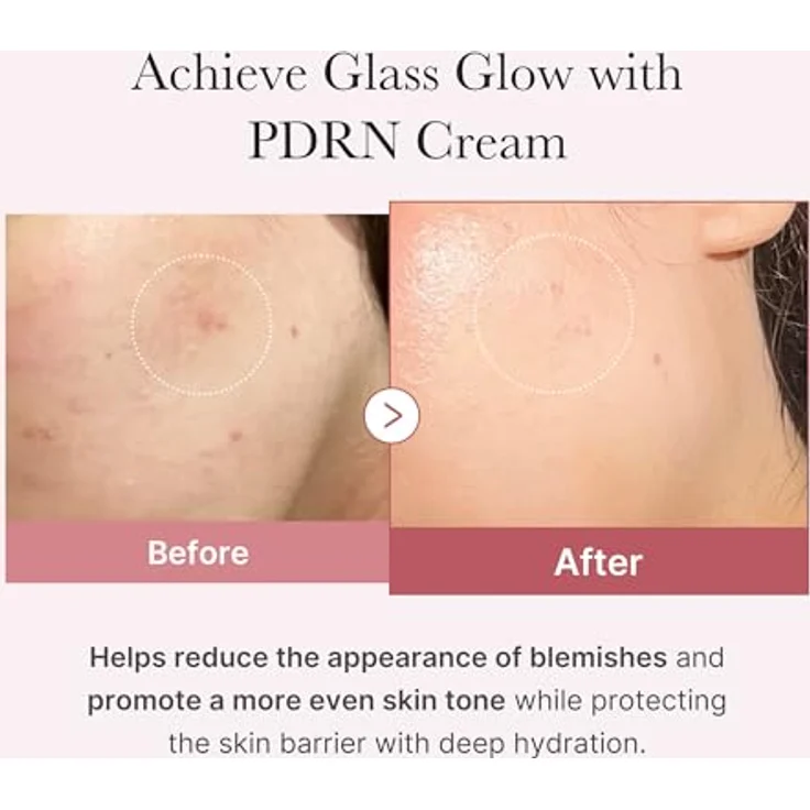 Medicube PDRN Pink Hyaluronic Moisturizing Cream 50ml – Koreanische Feuchtigkeitscreme mit Salmon DNA, 10-fach Hyaluronsäure, Niacinamid, Ceramiden & Peptiden – Anti-Aging, Hydration & Hautbarriere-Stärkung – Bild 3