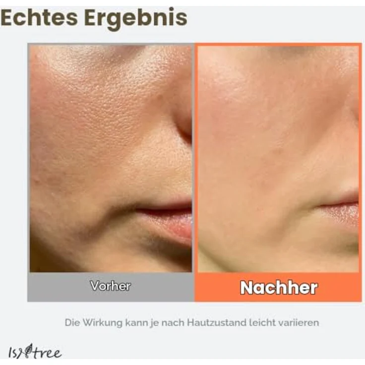Isntree Green Tea Gesichts-Tonikum, beruhigend für gemischte bis fettige Haut, 200 ml – Bild 5