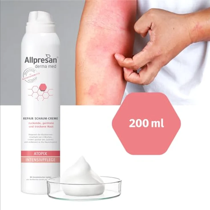Allpresan Derma med ATOPIX INTENSIVPFLEGE Schaum-Creme, 200 ml - Medizinische Hautpflege bei Neurodermitis, repariert die Hautbarriere, lindert Juckreiz – Bild 3