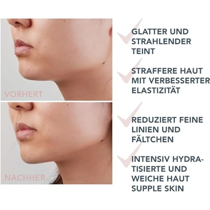 Foreo Supercharged Triple-Action Firming Serum Conductive Gel, Anti-Aging Gesichtsserum mit Hyaluronsäure und Squalan, 30 ml – Bild 5