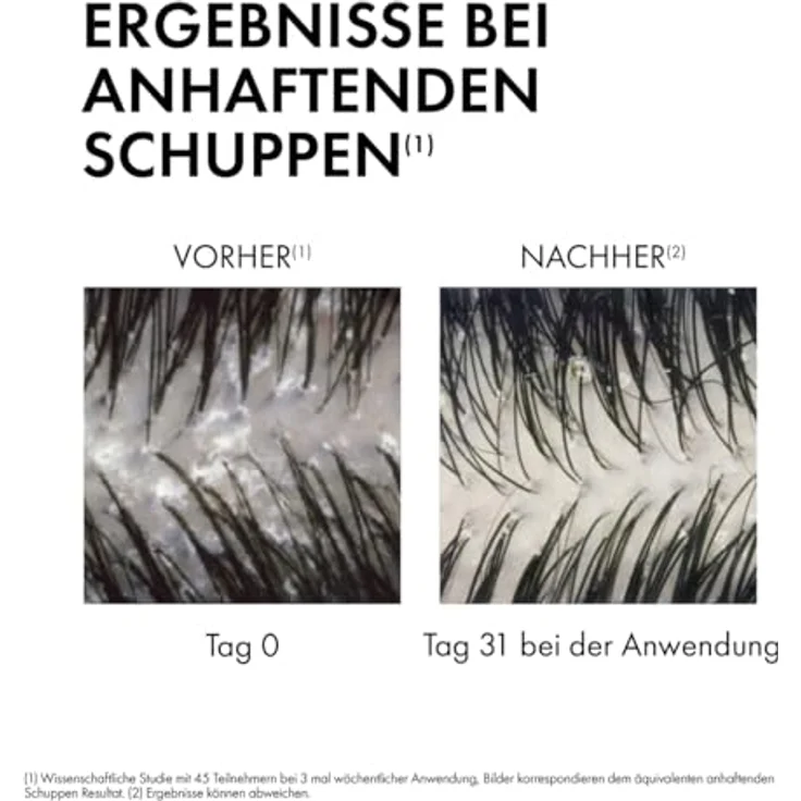 Vichy Dercos Anti-Dandruff Shampoo gegen Schuppen für trockenes Haar 390 ml – Bild 3