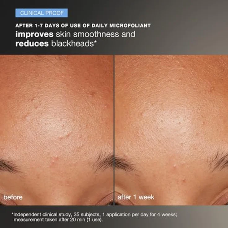 Dermalogica Skin Health System Discover Healthy Skin Kit Gesichtspflegeset 1 Stück mit pflegender Wirkung – Bild 3