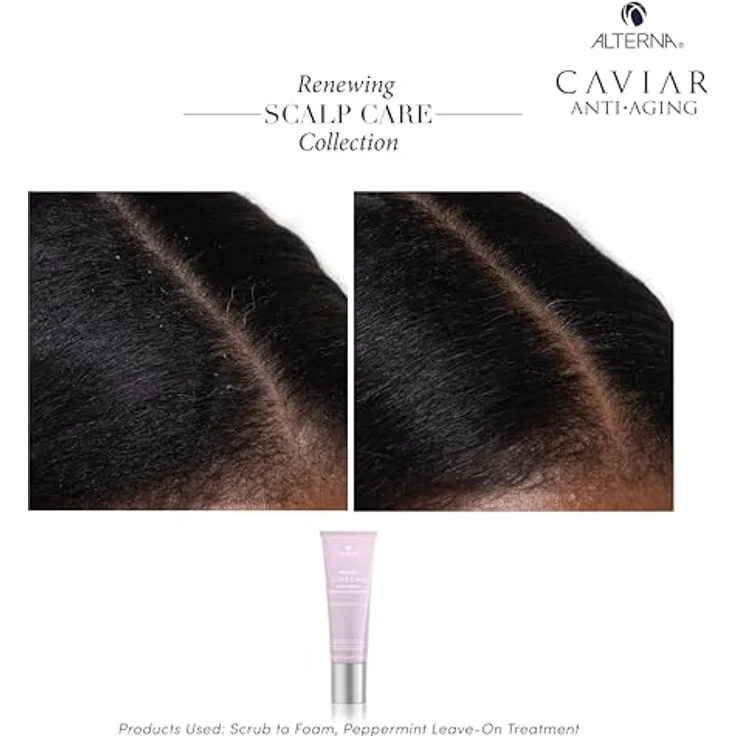 Alterna Renewing Scalp Care Peppermint Leave-on Treatment, feuchtigkeitsspendende Haarkur für trockene Kopfhaut, 74 ml – Bild 7