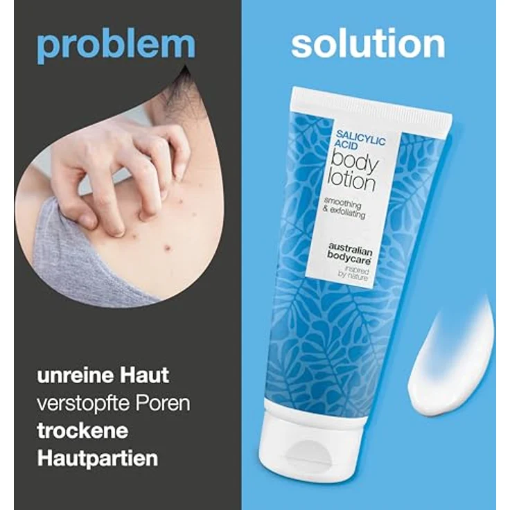 Australian Bodycare Bodylotion mit Salicylsäure, BHA, Niacinamid und Hyaluronsäure – gegen Unreinheiten, trockene und fettige Haut, 300 ml – Bild 2