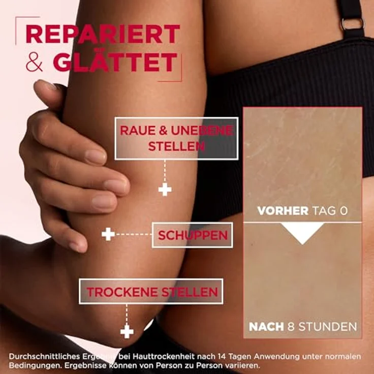 Mixa Urea Cica Repair, hauterneuernde Creme Bodylotion für raue und trockene Haut, 400 ml – Bild 4