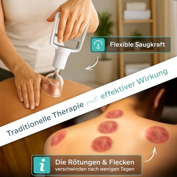 KURGLAS Massagegerät Schröpfgläser aus Kunststoff [14 Teilig], 14 Stück 14-tlg., Schröpfglas mit Vakuumpumpe & Faszienschaber, Schröpfset mit e-Book - Gegen Verspannungen & Cellulite, KURGLAS Massagegerät in 14-teiliger Ausführung – Bild 5