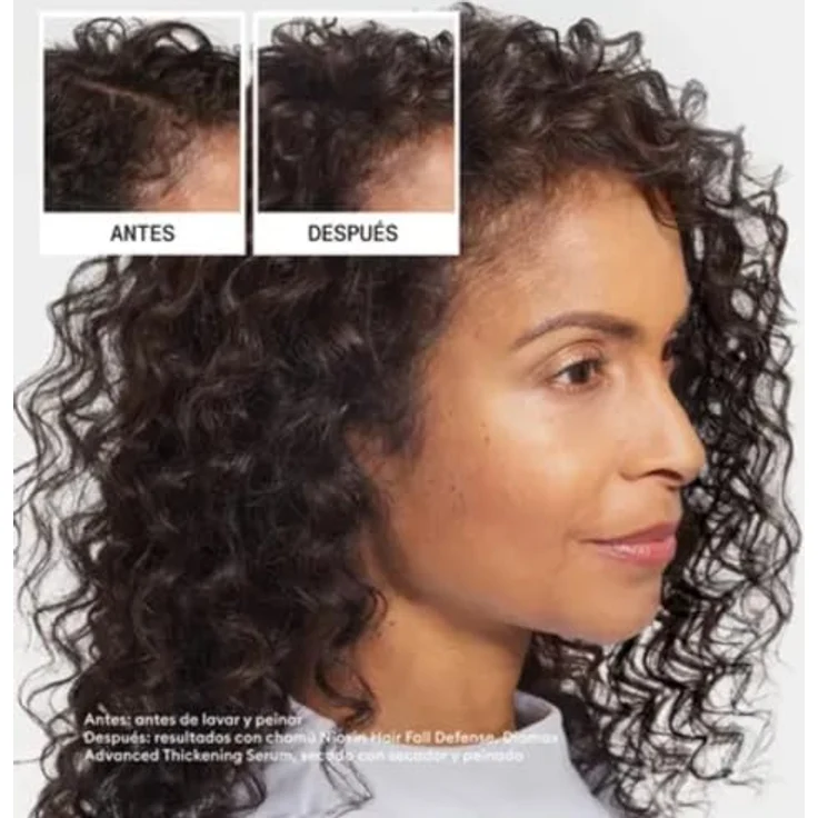 Nioxin Anti-Hair Loss Shampoo, Shampoo gegen Haarausfall, 240 ml für Damen, reinigt und beruhigt die Kopfhaut – Bild 3