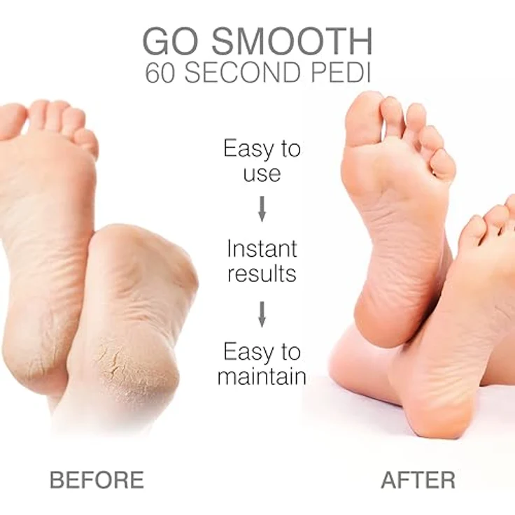 RIO Go Smooth Pedi Elektrischer Hornhautentferner, wasserdicht – Bild 5