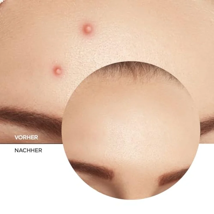 REVOX B77 Zitcare Tagescreme, 25 ml, Feuchtigkeitsspendende Gesichtscreme für unreine Haut – Bild 2