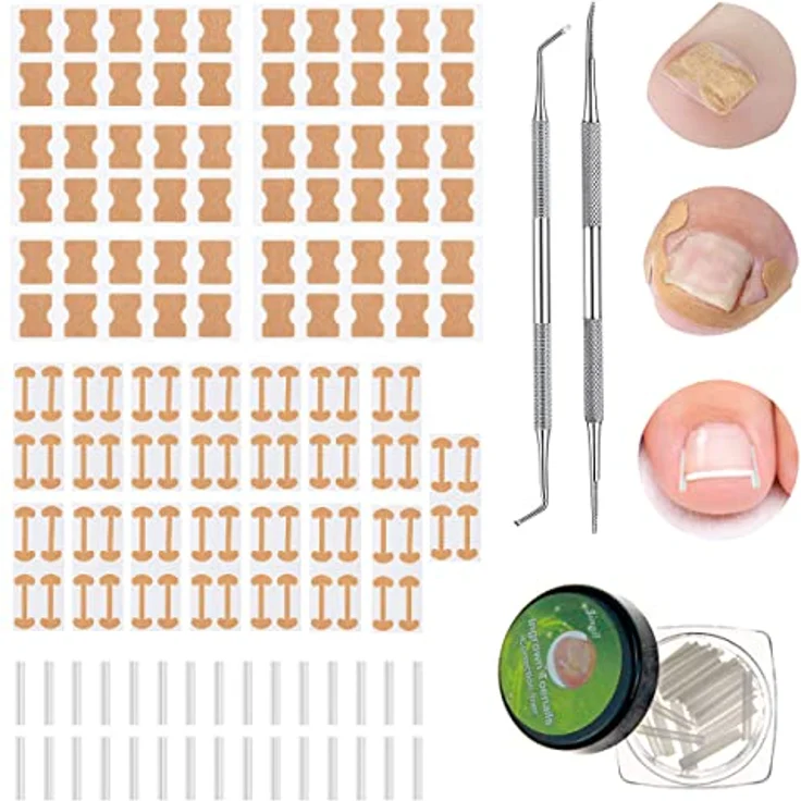 Leikedun 152 Stücke Eingewachsene Zehennägel Werkzeug Set, inkl. Nagelkorrektur Patch, gebogene Zehennagel Spangen, Zehennagel Feile & Heber für effektive Fußnagelpflege – Bild 1