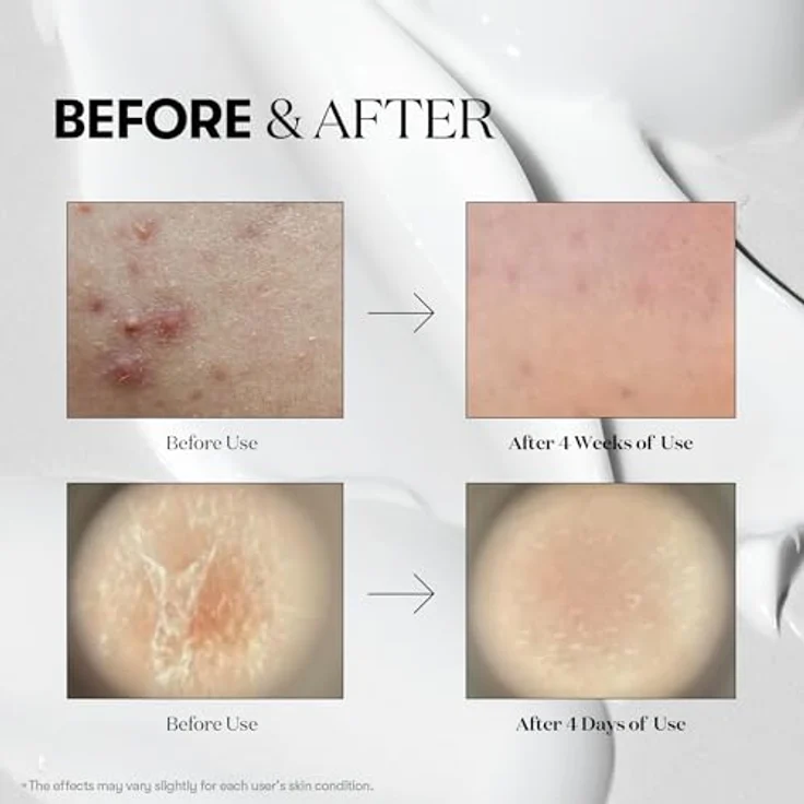 VT Cosmetics Reedle Shot 100, Mikronadel-Serum mit Cica Reedleâ„¢ für strahlende Haut, 50ml – innovative Mikronadel-Technologie – Bild 5