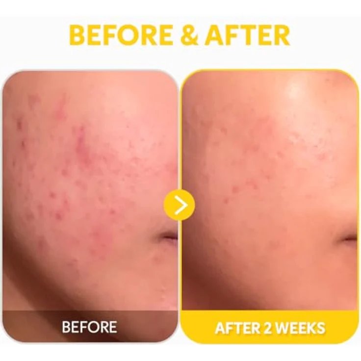 TIRTIR Pure Vitamin C24 Serum, aufhellendes Gesichtsserum mit antioxidativer Wirkung, 30 ml – Bild 8