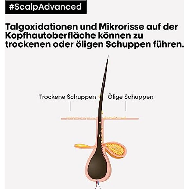 L'Oréal Professionnel Haarshampoo gegen Schuppen bei trockener & fettiger Kopfhaut, Scalp Advanced, Anti-Dandruff Dermo-Clarifier Shampoo, 300 ml – Bild 3