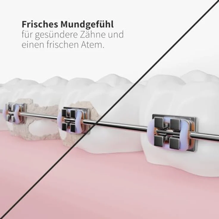 Zahnheld® Ersatzdüsen Sensitiv für Munddusche Aquadent, sanfte Gummi-Spitze für empfindliche Zähne und Zahnfleisch – Bild 5