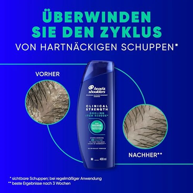 Head & Shoulders Cooling Itch Rescue, Anti-Schuppen Shampoo mit 1% Selensulfid, 400ml, Clinical Strength, für hartnäckige Schuppen und Juckreiz, mit intensivem kühlendem Menthol – Bild 3