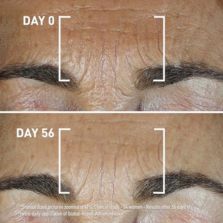 FILORGA Global-Repair Advanced Elixir 30 ml Gesichtsserum - Kühl und bequem, zusätzlicher Komfort – Bild 5