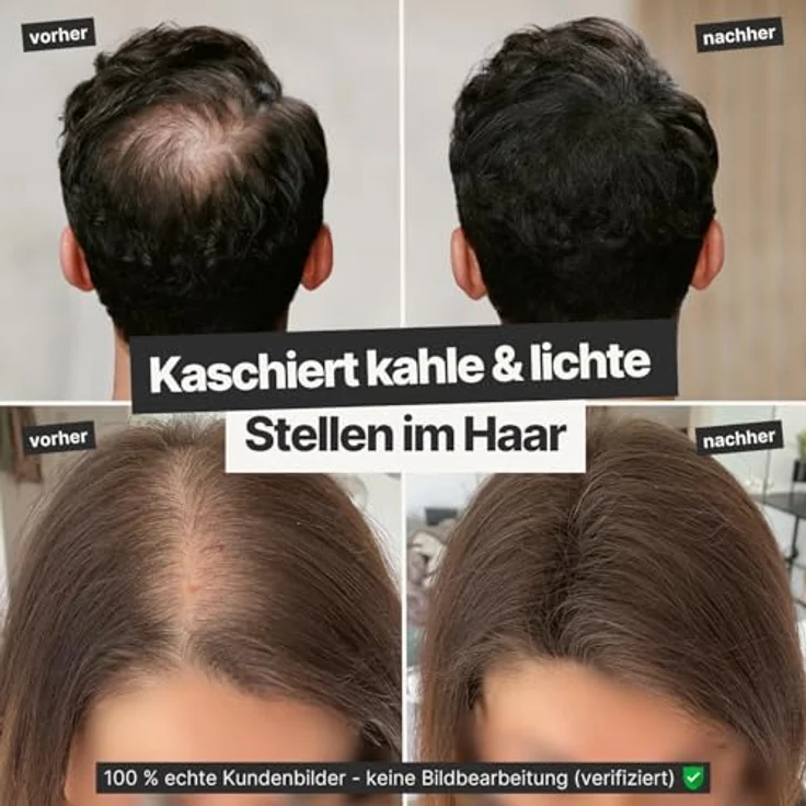 IMPERIO Streuhaar zur Haarverdichtung, 100% Naturfasern, Premium Friseurqualität, 26g, Dunkelbraun – Bild 2