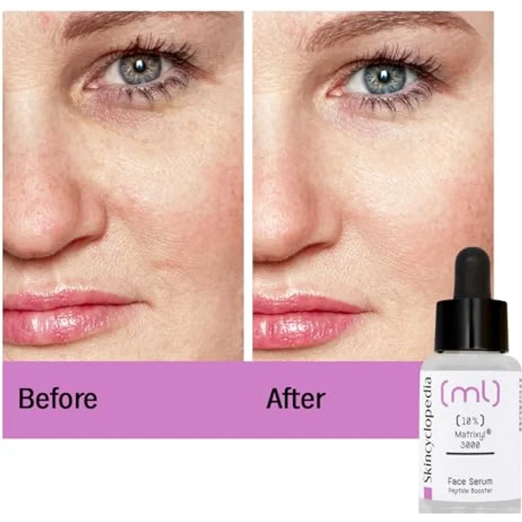 Skincyclopedia Peptide Serum mit 10% Matrixyl 3000, Anti-Aging Gesichtspflege, reduziert Falten, 30ml – Bild 2