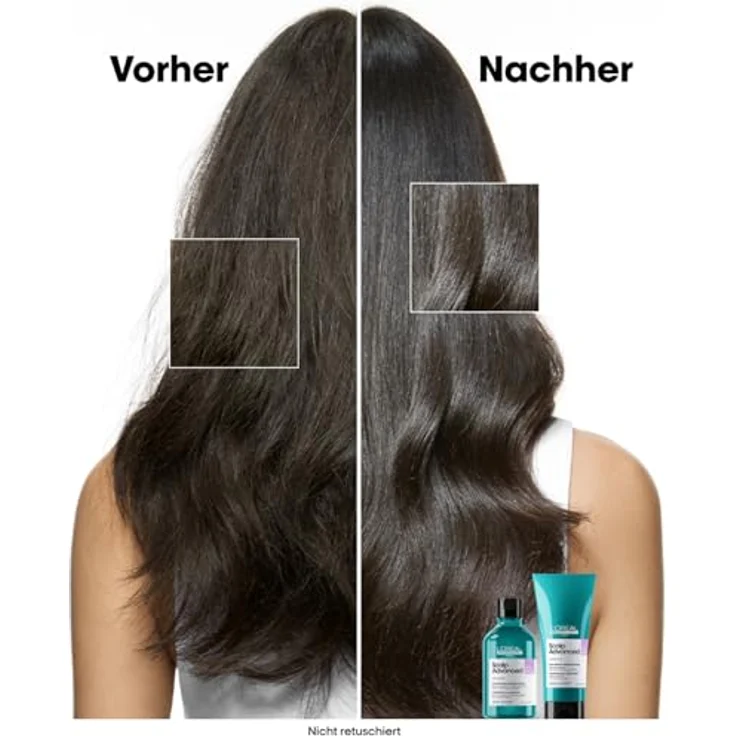 L'Oréal Professionnel Scalp Advanced, Anti-Discomfort Dermo-Regulator Shampoo zum Nachfüllen, 500ml - Beruhigt empfindliche Kopfhaut – Bild 3