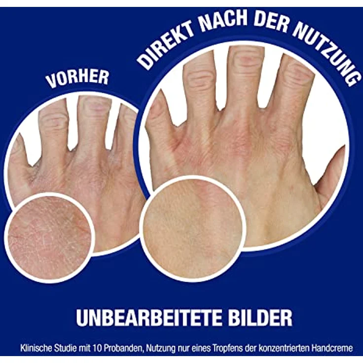 Neutrogena Handcreme konzentriert parfümiert (50ml), beruhigende Feuchtigkeitscreme mit 40% Glycerin + Vitamin E bei extrem trockenen, rissigen Händen – Bild 3