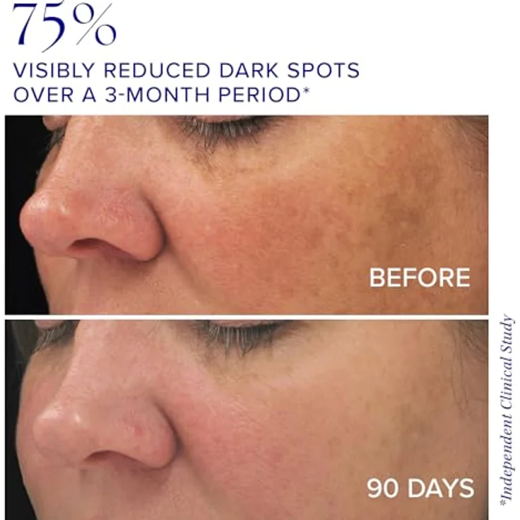 iS Clinical Brightening Complex 30 g, Gesichtscreme gegen Hyperpigmentation mit Algen- und Heidelbeerextrakt, antioxidativ und porenverfeinernd – Bild 3