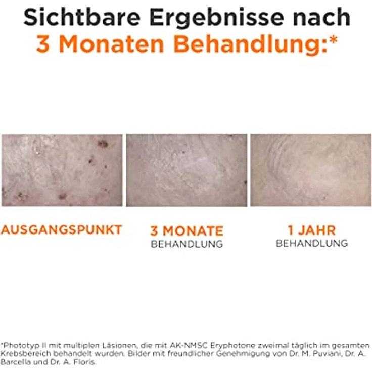 ISDIN Eryfotona AK Fluid LSF100+ (50 ml) | Prävention und begleitender Schutz bei Aktinischer Keratose | Sehr hoher UVB- und UVA-Schutz – Bild 4