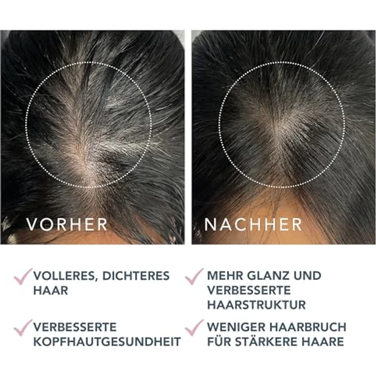Foreo LUNA Dual-Peptid-Kopfhautserum - Haarwachstumsserum & Kopfhautbehandlung mit Peptidkomplex, Cica & Portulak - Haarserum für Haarwachstum, Behandlung gegen Haarausfall - 60ml – Bild 5