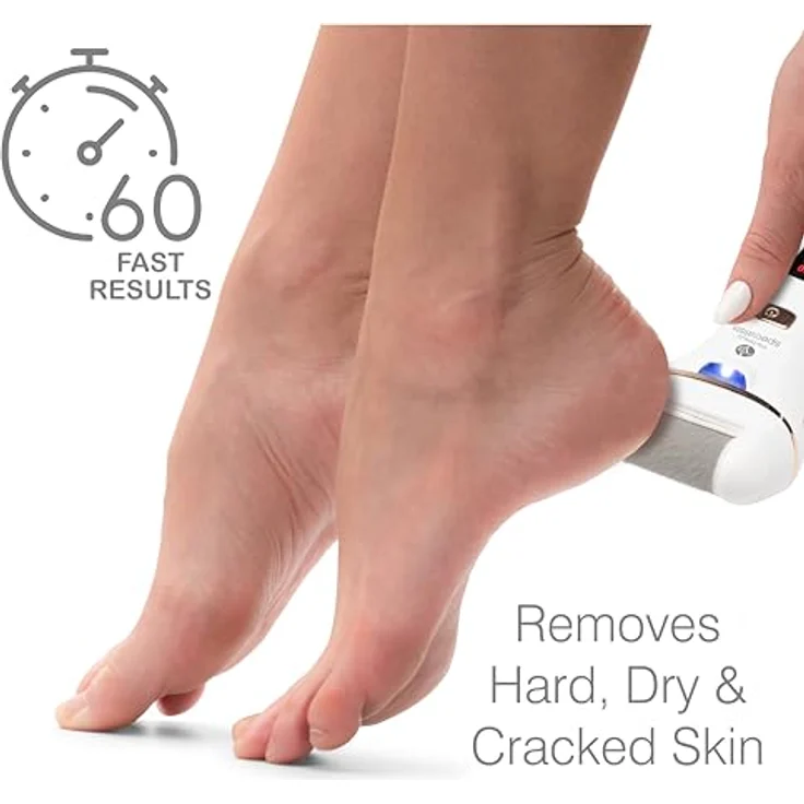 RIO Go Smooth Pedi Elektrischer Hornhautentferner, wasserdicht – Bild 4