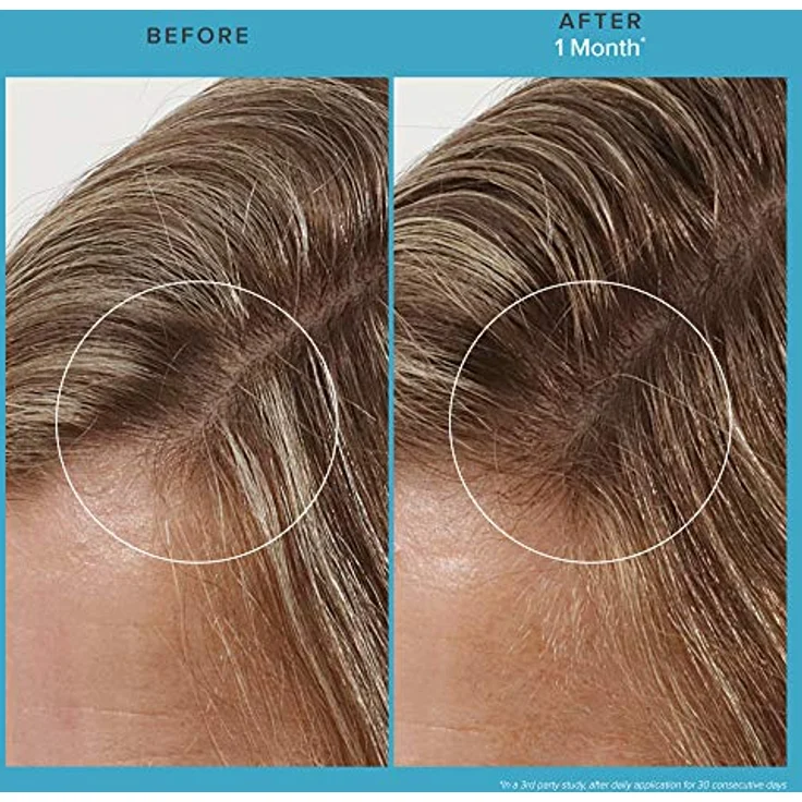 Living Proof Scalp Care Revitalizing Treatment 73 ml – Bild 2