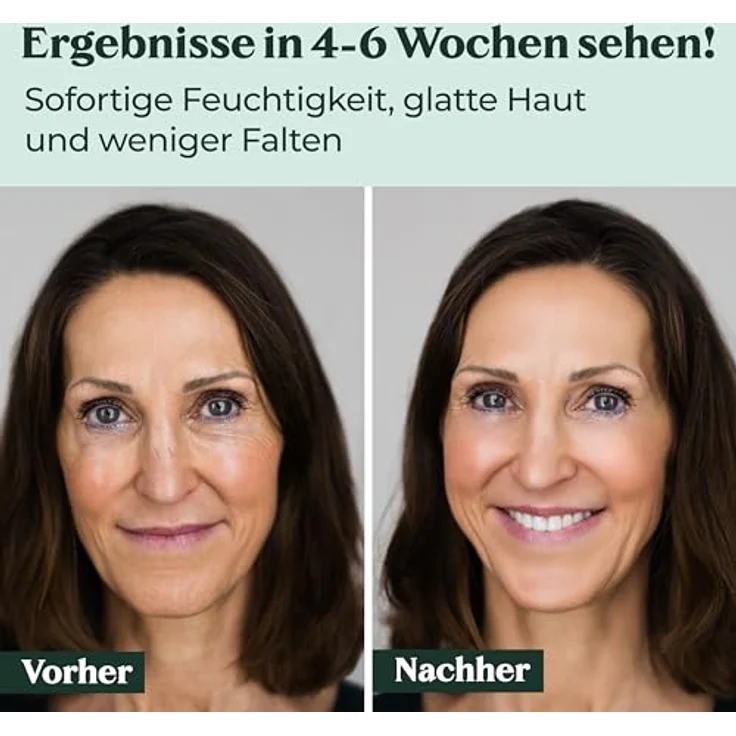 Cosphera Hyaluron Performance Creme 50 ml mit feuchtigkeitsspendender Wirkung für trockene Haut – Bild 6
