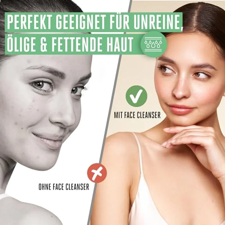 Vitabay Gentle Facial Cleanser zur Gesichtsreinigung 150ml - Reinigungsgel für Gesicht mit Zink PCA - Anti Pickel Waschgel Gesicht - Face Wash Cleanser Gesicht - Gesichtsreiniger Gesichtsreinigungsgel – Bild 2