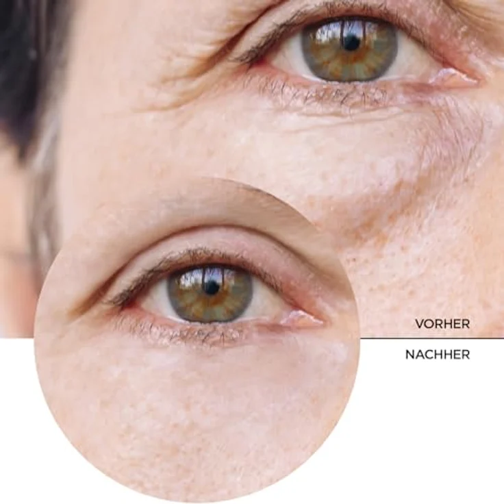 Revox Just 5% Caffeine Solution Augenserum gegen Augenringe und Schwellungen 30 ml für Frauen – Bild 8