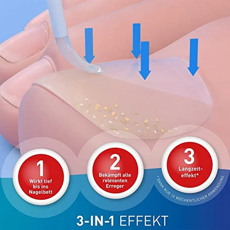 Loceryl Nagellack gegen Nagelpilz Direkt-Applikator, 5 ml – Bild 3