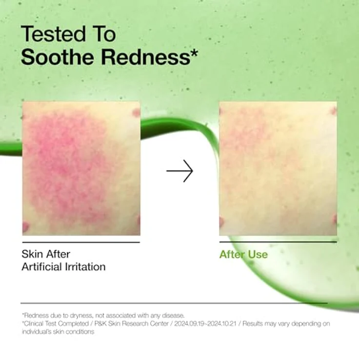 Anua Azelaic Acid 10+ Hyaluron Redness Soothing Serum, 30 ml, beruhigendes Gesichtsserum für empfindliche Haut – Bild 3