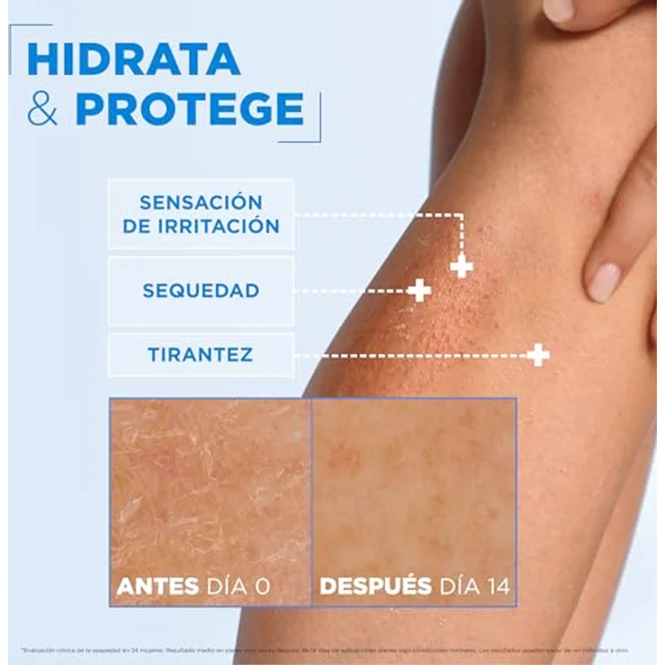 Mixa Ceramide Protect Körpercreme, 400 ml, Dermoprotector für trockene Haut – Bild 5
