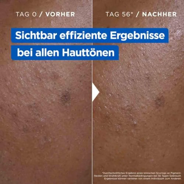 Mixa Niacinamide Bright Creme Körpermilch, Mildert pigmentierte Flecken, versorgt trockene Haut, 400 ml – Bild 5