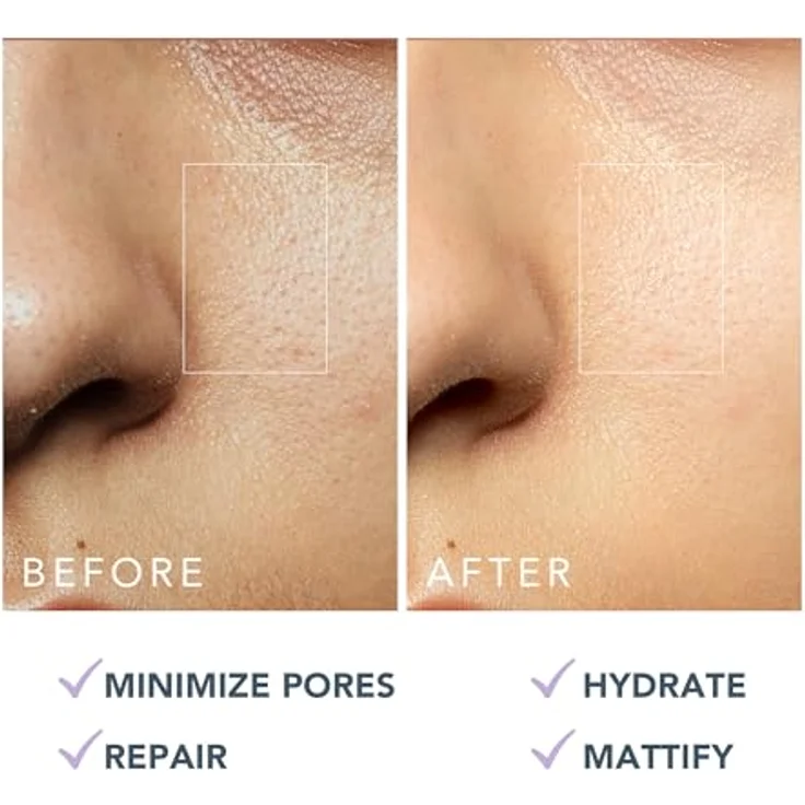 FOREO KIWI Oil Control Mattierende Feuchtigkeitscreme - Vegan, 40 ml, für fettige Akne-Haut & mit Aftercare-Pflege - Hautverträglichkeit bestätigt, in grün – Bild 5