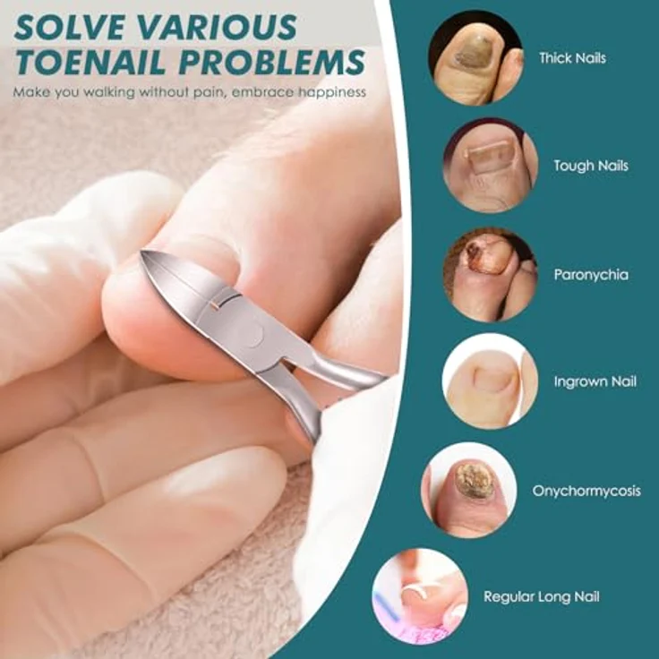 Auxmir Nagelschere, Profi Nagelzange für starke Fußnägel, scharfe Klingen aus Edelstahl, ergonomisches Design mit Schutzkappe – Bild 2