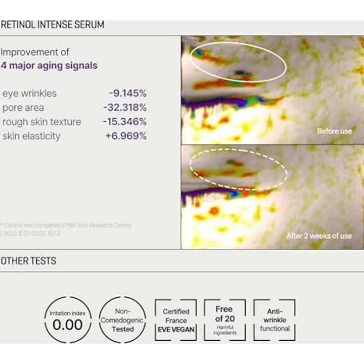 Some By Mi Retinol Intense Trial Kit, Augenpflege-Set mit Anti-Aging Retinol-Serum und feuchtigkeitsspendender Augencreme, 10 ml je Produkt – Bild 5